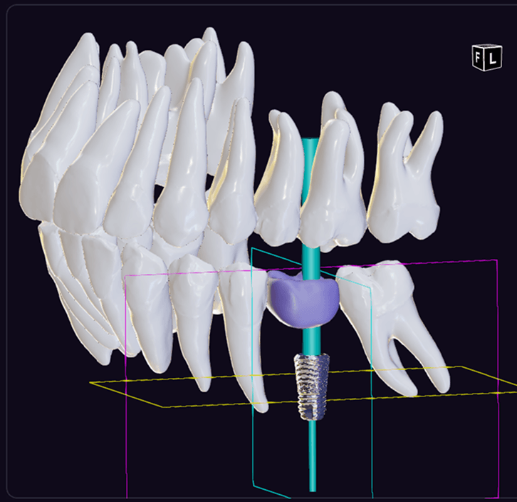 diagnocatProducts.implantat