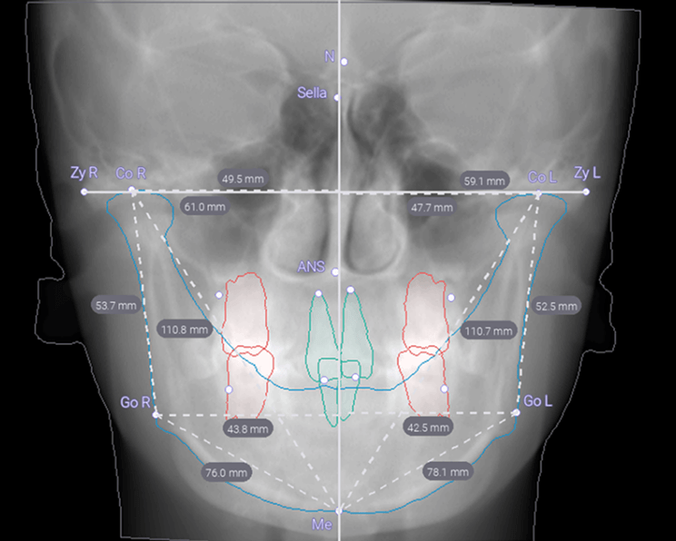diagnocatProducts.ortho
