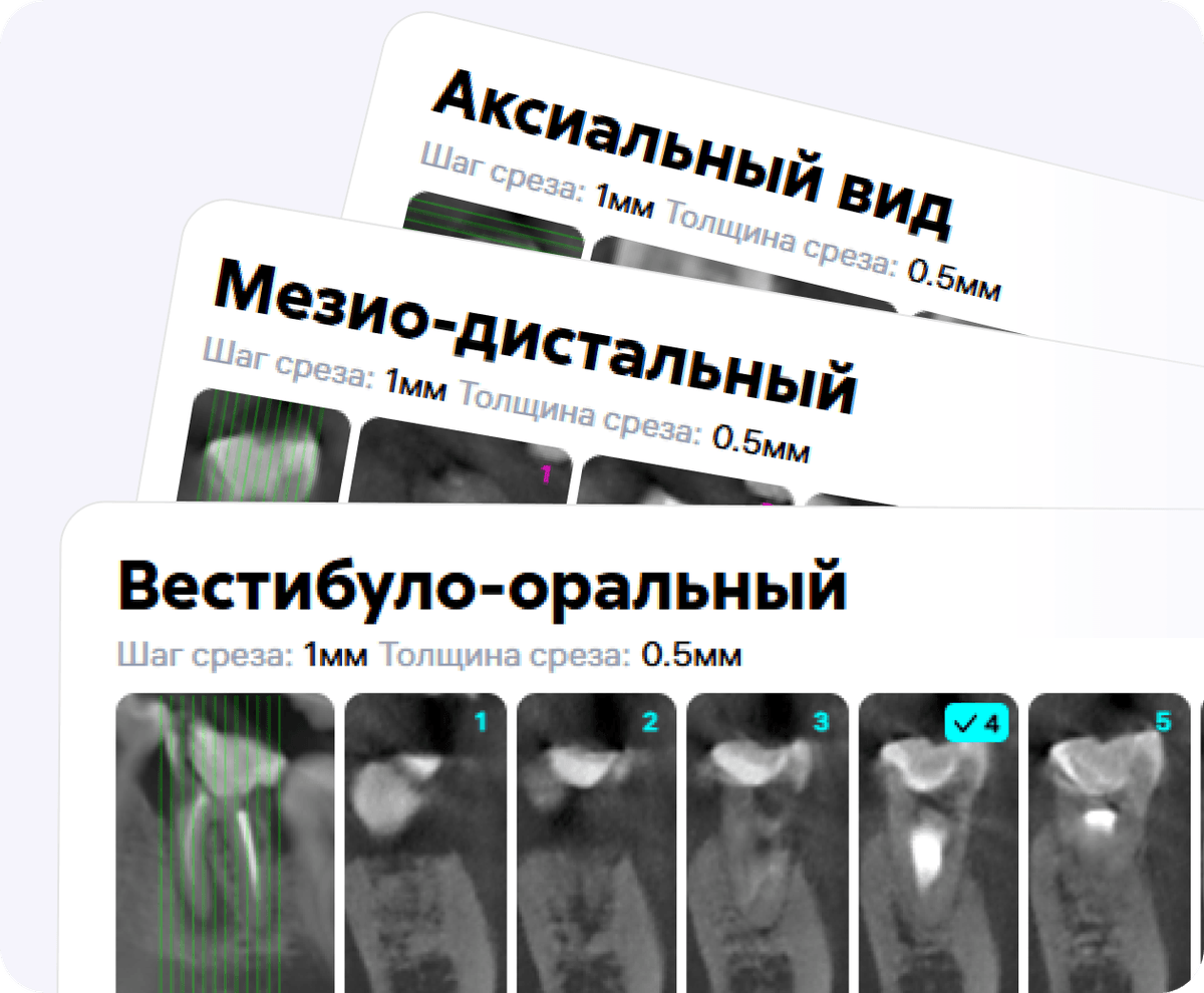 [object Object], Панель содержит расширенную визуализацию срезов в трех плоскостях.