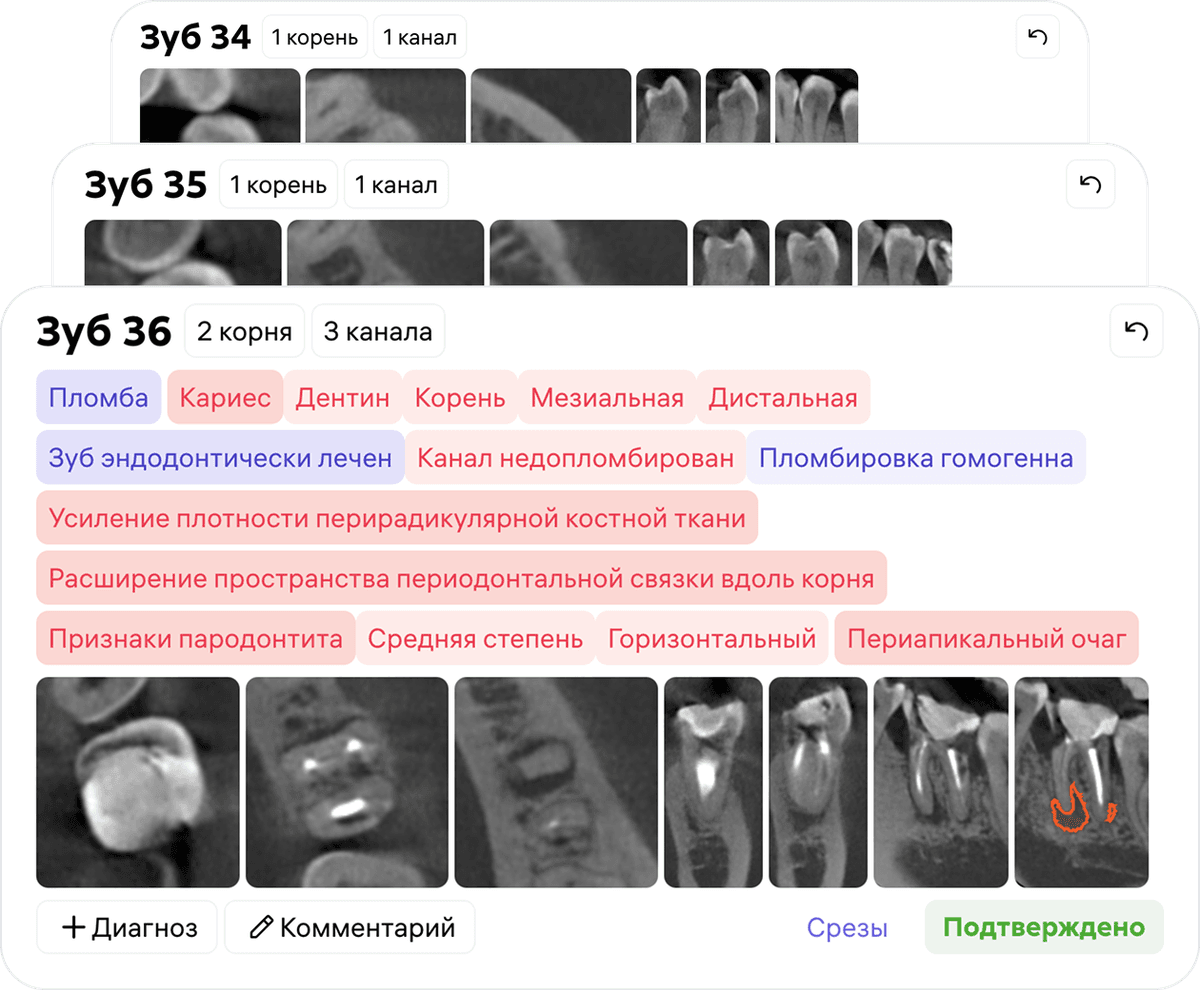 [object Object], После ознакомления со скринингом Diagnocat врач может подтвердить или скорректировать результаты.