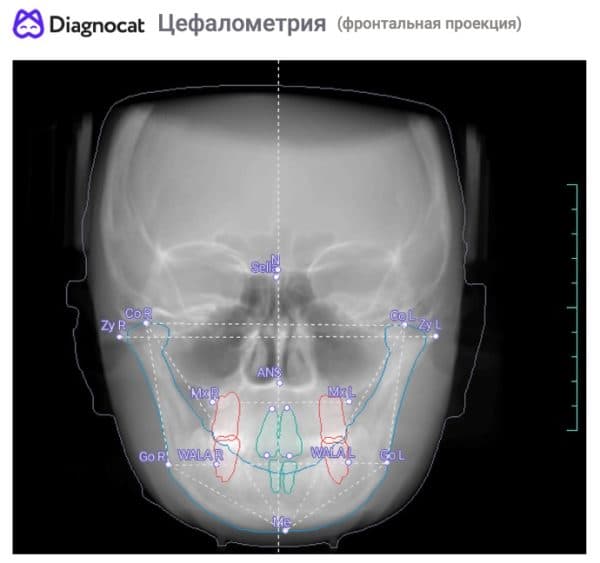 Ортодонтический отчёт