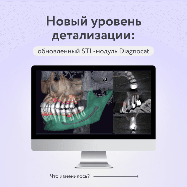 Обновления в STL-модуле!
