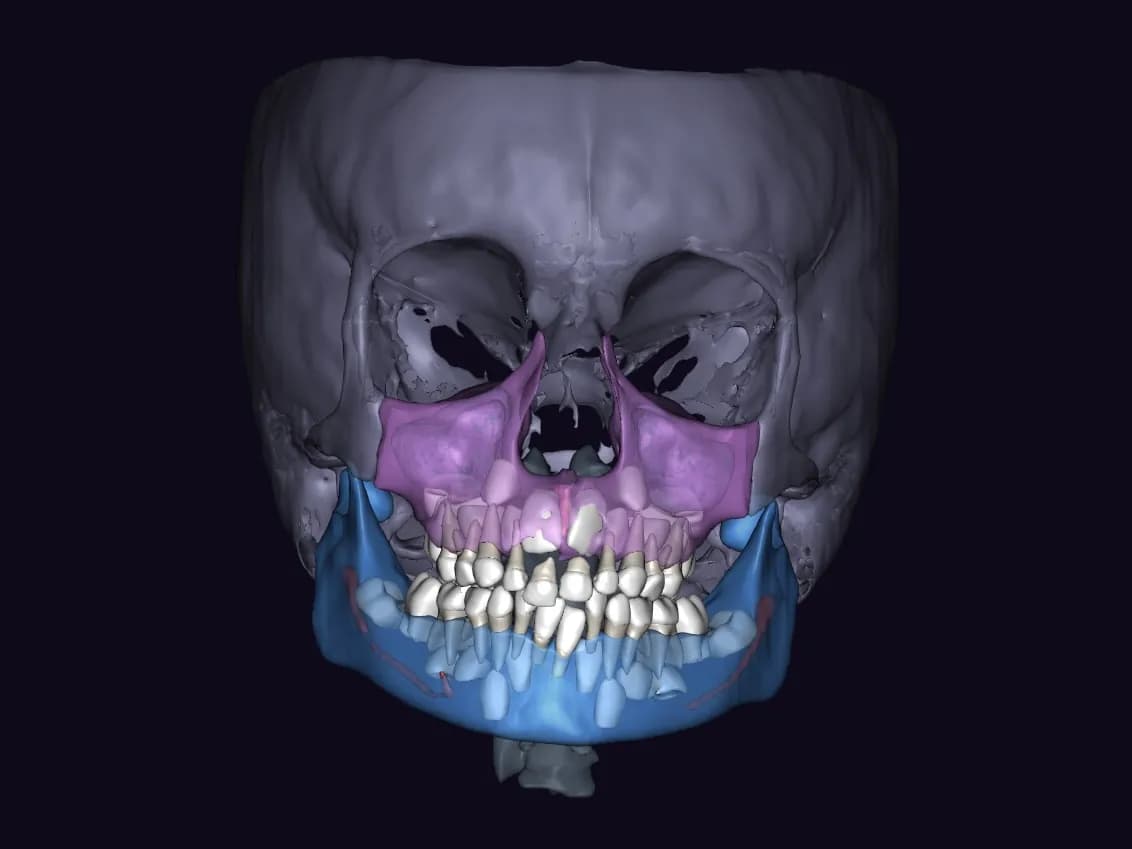 Реконструкция в 3D отчёте Diagnocat при обращении
