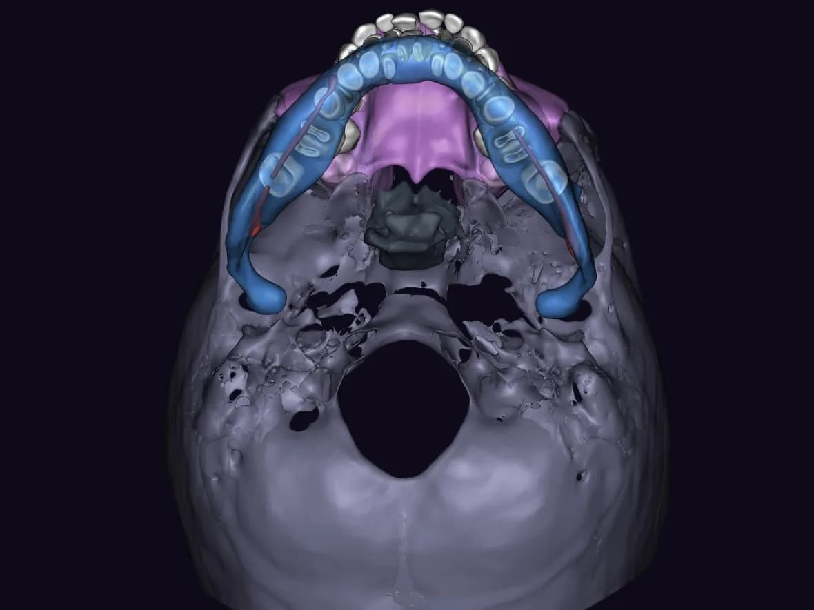 Реконструкция в 3D отчёте Diagnocat при обращении