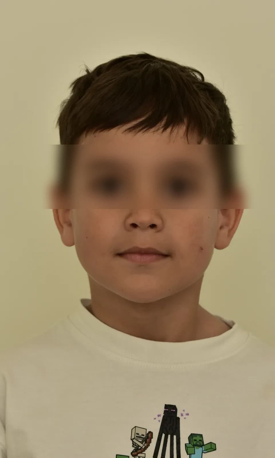 Фотопротокол через 7 месяцев ортодонтического лечения