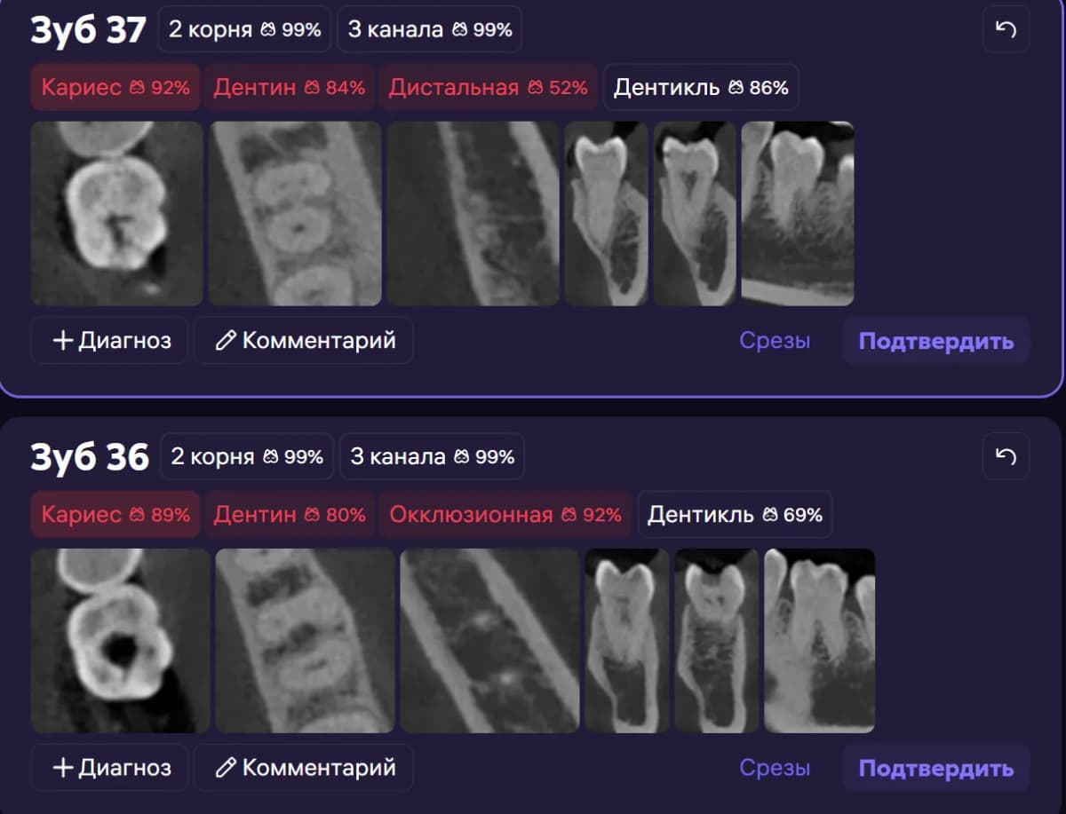 Срезы в области зубов 3.6, 3.7.